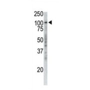 Restricted Expression Proliferation-Associated Protein 100 (P100) Antibody