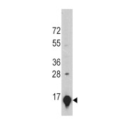 GLT Antibody