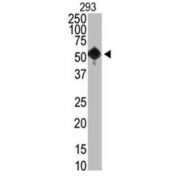 PR/SET Domain-Containing Protein 07 (SET07) Antibody