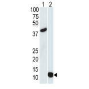 Small Ubiquitin-Related Modifier 3 (SUMO3) Antibody