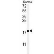 Ubiquitin Carrier Protein 9 (UBC9) Antibody