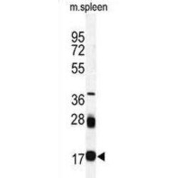 Ubiquitin Carrier Protein 9 (UBC9) Antibody