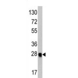 Ubiquitin-Like Protein ATG12 (ATG12) Antibody