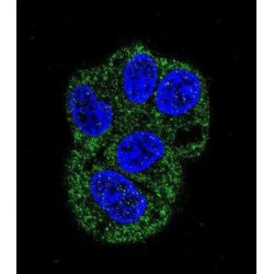 Lactotransferrin (LTF) Antibody