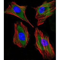 Lactotransferrin (LTF) Antibody