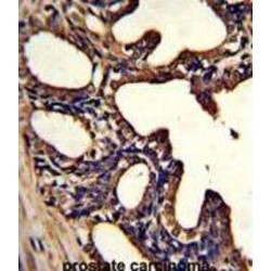 Lactotransferrin (LTF) Antibody