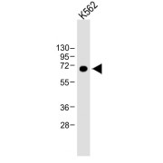 WB analysis of K562 whole cell lysates, using LTF antibody (1/8000 dilution). Predicted band size: 78 kDa. Blocking/dilution buffer: 5% NFDM/TBST.