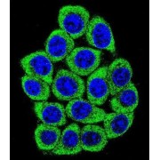 Nucleolin (NCL) Antibody