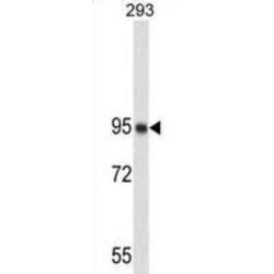 Nucleolin (NCL) Antibody