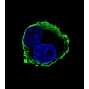 Matrix Metalloproteinase 14 (MMP14) Antibody