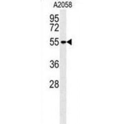 Matrix Metalloproteinase 14 (MMP14) Antibody