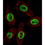 Histone-Lysine N-Methyltransferase EZH2 (EZH2) Antibody