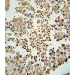 Histone-Lysine N-Methyltransferase EZH2 (EZH2) Antibody