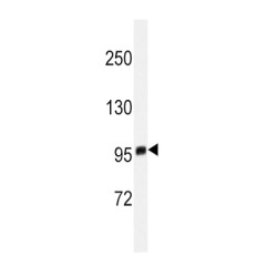 Histone-Lysine N-Methyltransferase EZH2 (EZH2) Antibody