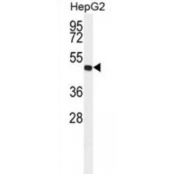 Fatty Aldehyde Dehydrogenase (ALDH3A2) Antibody
