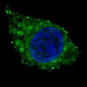 Retinal Dehydrogenase 1 (ALDH1A1) Antibody