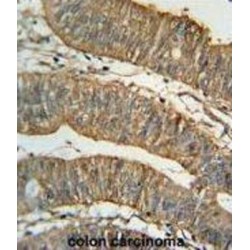 Retinal Dehydrogenase 1 (ALDH1A1) Antibody