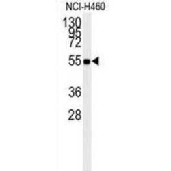 Retinal Dehydrogenase 1 (ALDH1A1) Antibody