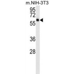 RAC-Gamma Serine/threonine-Protein Kinase (AKT3) Antibody