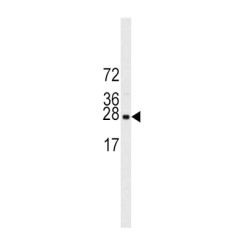 Eukaryotic Translation Initiation Factor 4E (EIF4E) Antibody