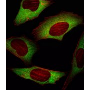 Eukaryotic Translation Initiation Factor 4E (EIF4E) Antibody