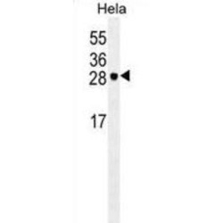 Eukaryotic Translation Initiation Factor 4E (EIF4E) Antibody