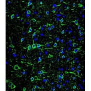 Microtubule Associated Protein 2 (MAP2) Antibody