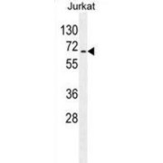 Ribosomal Protein S6 Kinase Beta 2 (RPS6KB2) Antibody