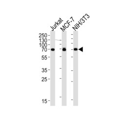 Ribosomal Protein S6 Kinase Beta 2 (RPS6KB2) Antibody