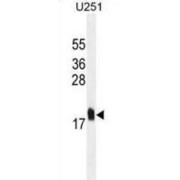 Multiple Coagulation Factor Deficiency Protein 2 (MCFD2) Antibody