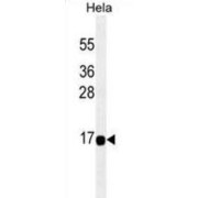 Acyl-Coenzyme A Thioesterase 13 (ACOT13) Antibody