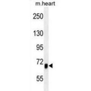 Activin A Receptor Type 1B (ACVR1B) Antibody