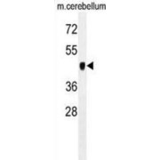 Pyruvate Dehydrogenase Kinase Isozyme 2 (PDK2) Antibody