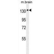 Neurotrophic Receptor Tyrosine Kinase 1 (NTRK1) Antibody