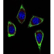 Retinol (RET) Antibody