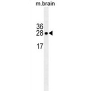 Latexin (LXN) Antibody