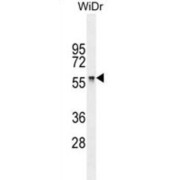 Chaperone Activity of Bc1 Complex-Like (CABC1) Antibody