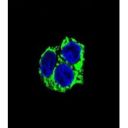 Chaperone Activity of Bc1 Complex-Like (CABC1) Antibody