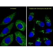 Autophagy Related 4D Cysteine Peptidase (ATG4D) Antibody