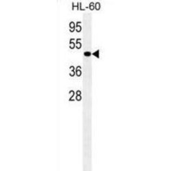 Autophagy Related 4D Cysteine Peptidase (ATG4D) Antibody