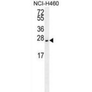 Eukaryotic Translation Initiation Factor 4E Type 2 (EIF4E2) Antibody