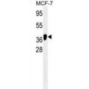 Autophagy Related 4B Cysteine Peptidase (ATG4B) Antibody