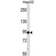 Mitogen-Activated Protein Kinase Kinase Kinase 11 (MAP3K11) Antibody