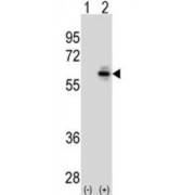 Cell Division Cycle 25C (CDC25C) Antibody