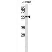 Nucleoporin 50 (NUP50) Antibody