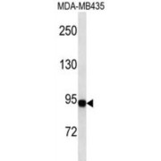 Gelsolin (GSN) Antibody