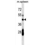 B-Cell Antigen Receptor Complex-Associated Protein Alpha Chain (CD79A) Antibody