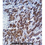 Lectin-Galactoside Binding Soluble 3 (LGALS3) Antibody