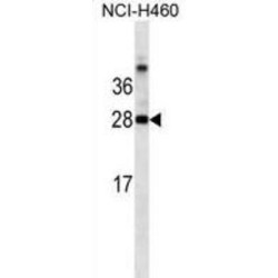 Lectin-Galactoside Binding Soluble 3 (LGALS3) Antibody