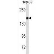Neural Cell Adhesion Molecule 1 / CD56 (NCAM1) Antibody